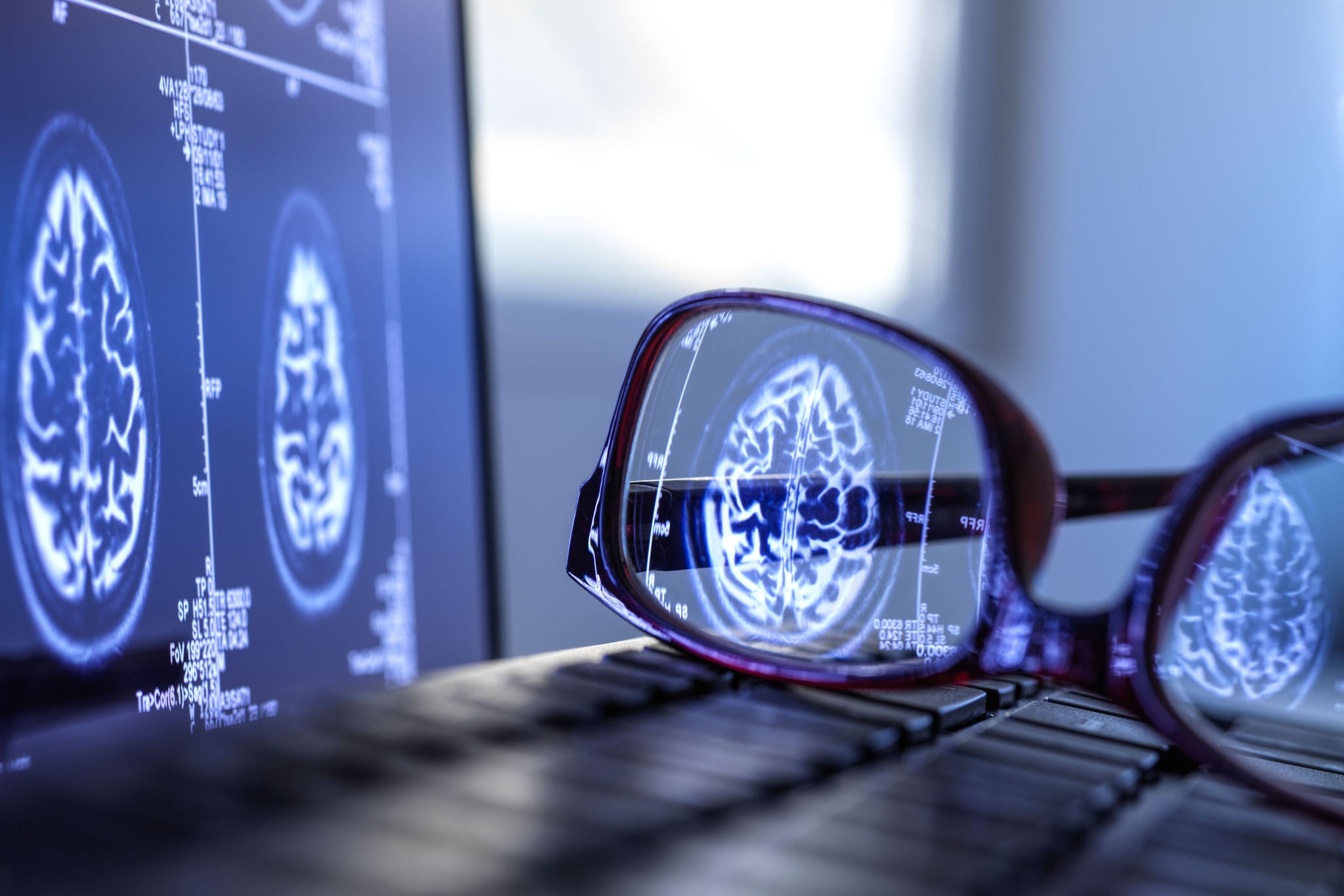 Brain scan results reflecting in protective glasses lying on laptop keyboard