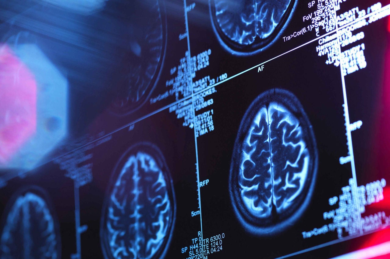 Human brain scan in a neurology clinic 