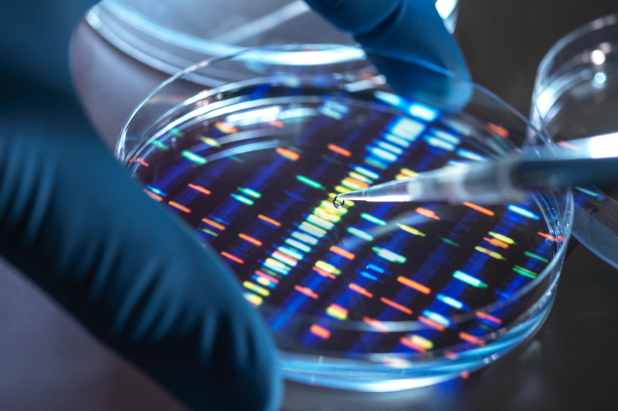 Scientist pipetting sample into tray for DNA testing in laboratory