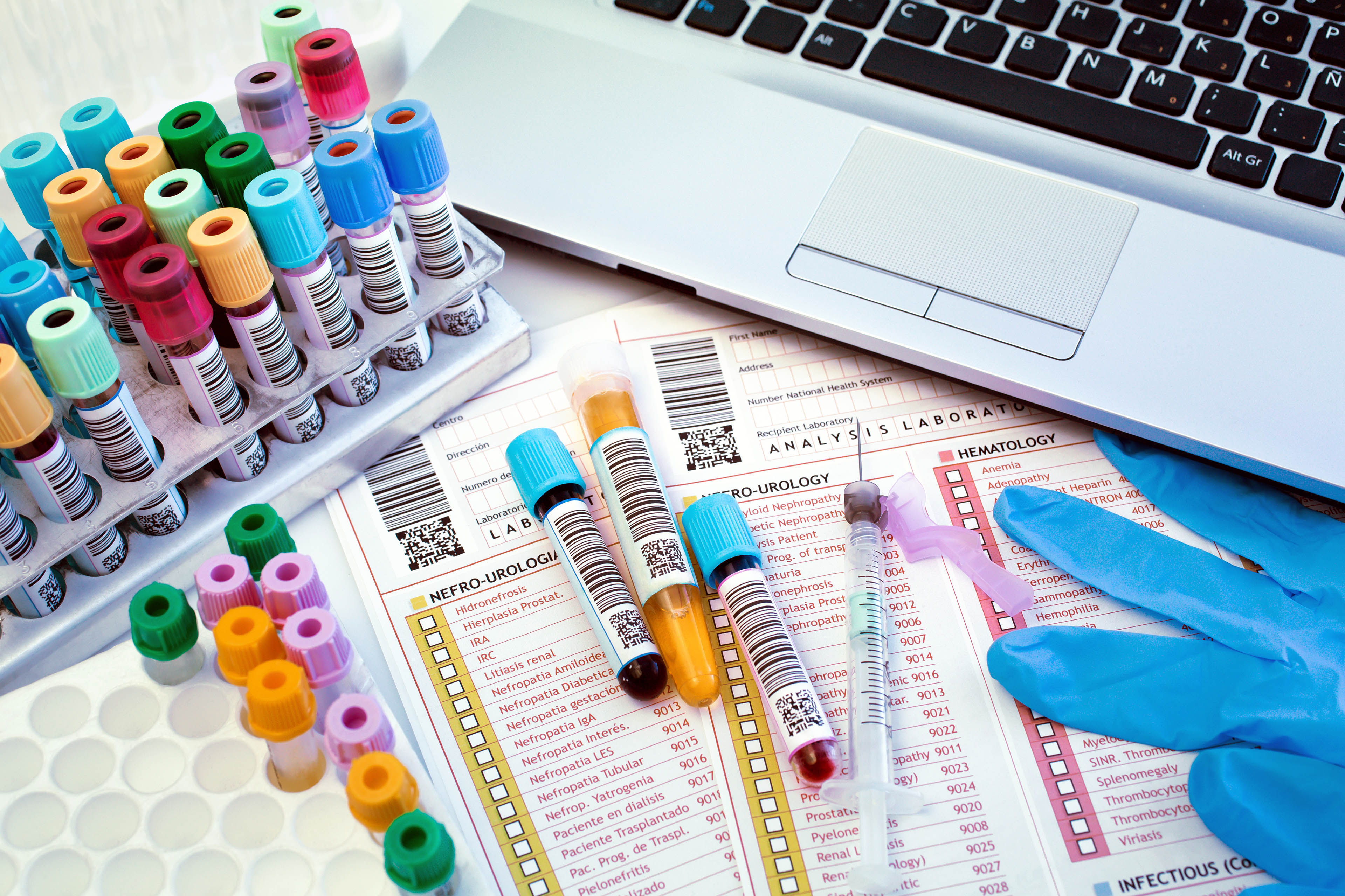 laboratory work table with tools of a lab technician to perform a blood test